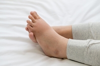 Causes of Foot Pain During Pregnancy