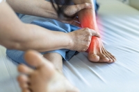Conditions That Can Cause Burning in the Feet