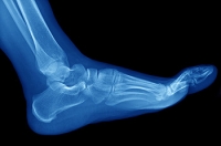Understanding the Musculoskeletal Marvels of the Feet